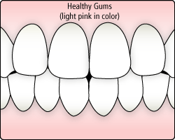 healthy gums